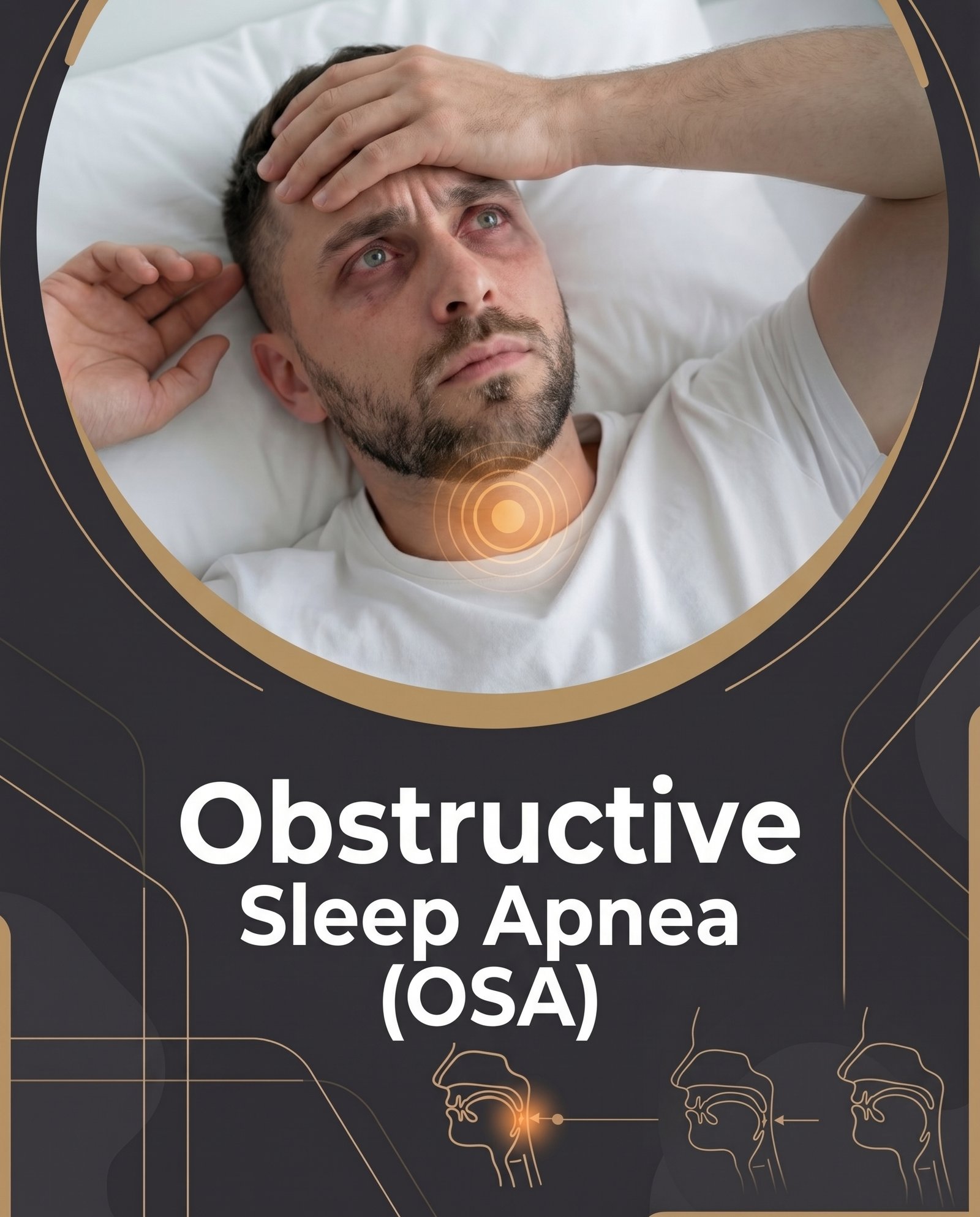 Obstructive Sleep Apnea (OSA) — 32 Dental & TMJ Solutions